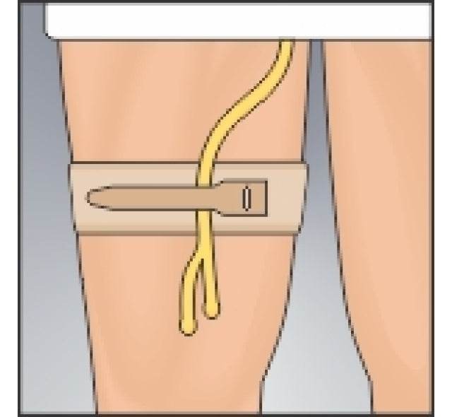 Urocare Catheter Tubing Strap