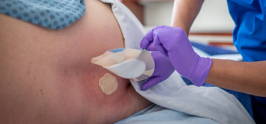 How to Choose the Right Wound Dressing for Different Levels of Drainage