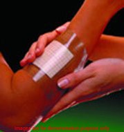 Opsite Flexifix Transparent Film Roll, Size 15Cm X 10M